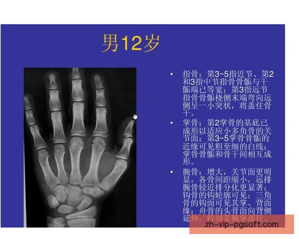 跳高骨龄评估方法，科学预测少年发展潜力